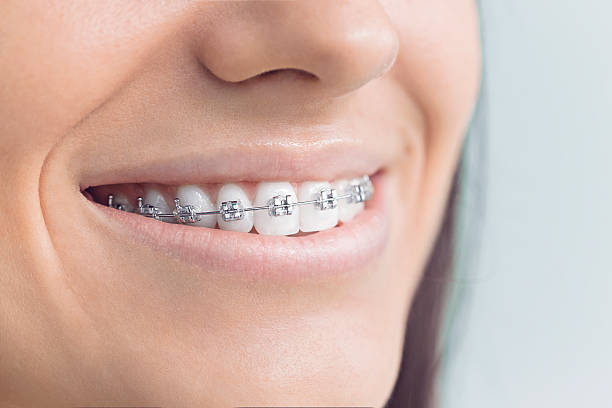 Best Invisalign and Clear Aligners  in Woodbine, GA